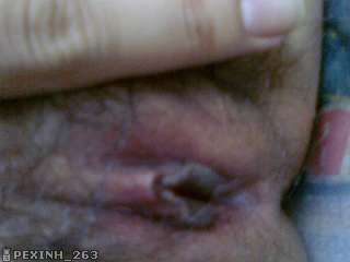 Anh Sex